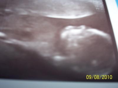 Bild zu Hier noch das Bildchen - Forum für Februar - Mamis