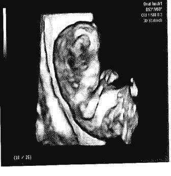 Bild zu Baby-TV - Forum für Februar - Mamis
