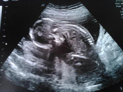 Bild zu Penis oder Kitzler... - Forum für Februar - Mamis