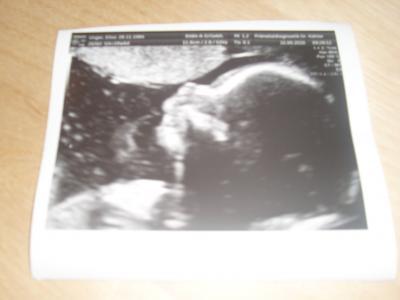 Bild zu Zurück von der Feindiagnostik! - Forum für Februar - Mamis