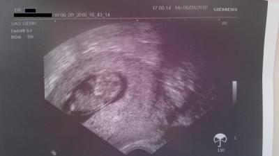 Bild zu Schaut ma wie schnell jetzt die zeit vergeht... - Forum für Februar - Mamis