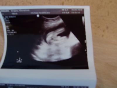 Bild zu Mal wieder melden und FA-Besuch - Forum für Februar - Mamis