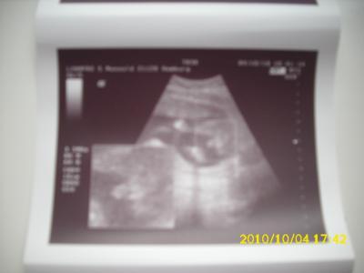 Bild zu Zurück von 2 Ultraschall! - Forum für Februar - Mamis