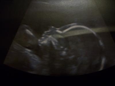 Bild zu nachträglich noch ein profil und der schnipel von meinem sohn :-))) - Forum für Februar - Mamis