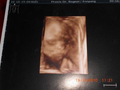 Bild zu 3D-Ultraschallbild - Forum für Februar - Mamis