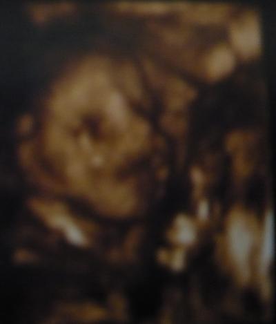 Bild zu Darf ich vorstellen, meine kleine Lana! - Forum für Februar - Mamis