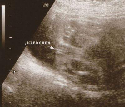 Bild zu Habt ihr Outingbilder bekommen? - Forum für Februar - Mamis