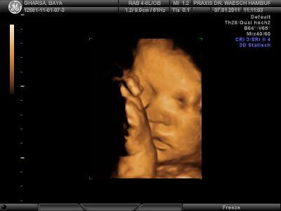 Bild zu zurück vom FA... - Forum für Februar - Mamis