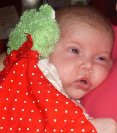 Bild zu Wessen Baby hat denn noch Babyakne!? - Forum für Februar - Mamis
