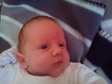 Bild zu