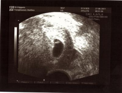 Bild zu War heute beim Doc. - Forum für Februar - Mamis