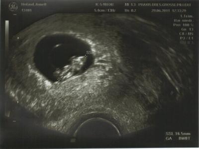 Bild zu hab ne kleine maus im bauch. - Forum für Februar - Mamis