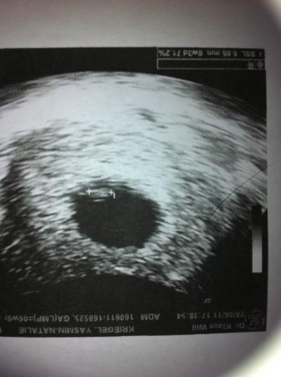 Bild zu mal ein bild von mir - Forum für Februar - Mamis