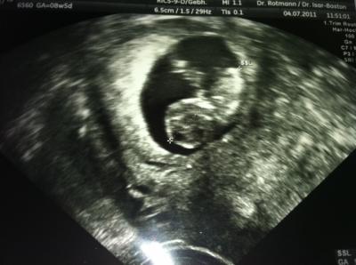 Bild zu Endlich Termin gehabt!!! - Forum für Februar - Mamis