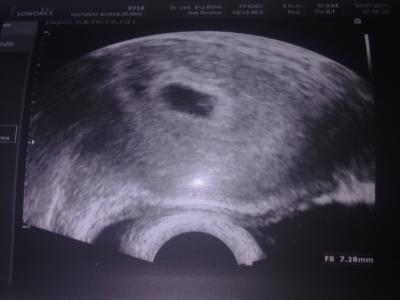 Bild zu Mal mein Pünktchen zeigen ;-) - Forum für Februar - Mamis