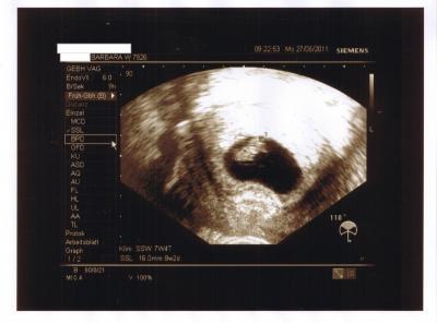 Bild zu Fotos... - Forum für Februar - Mamis