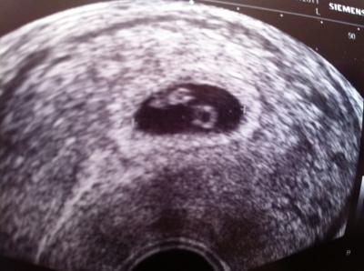 Bild zu Gestern auch beim Fa gewesen... - Forum für Februar - Mamis