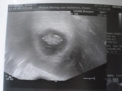Bild zu Gestern Termin gehabt :o) - Forum für Februar - Mamis