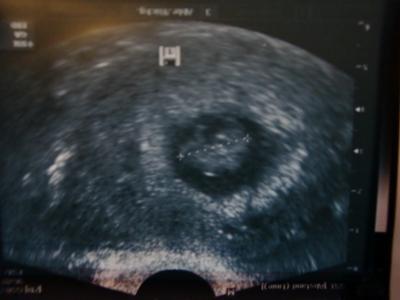 Bild zu Donnerstag Termin gehabt :-) - Forum für Februar - Mamis