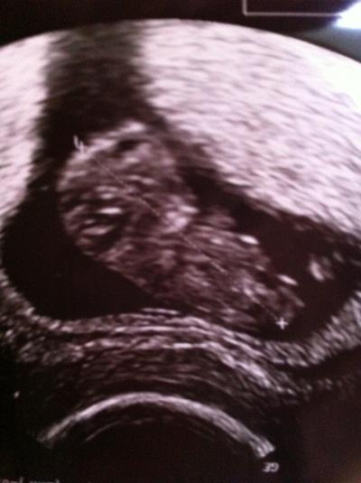 Bild zu Zurück vom FA - Forum für Februar - Mamis
