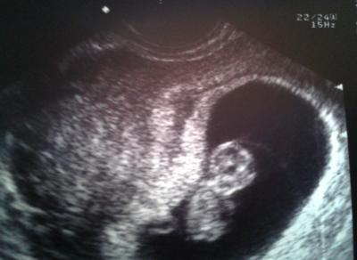 Bild zu Mein Krümel :) - Forum für Februar - Mamis