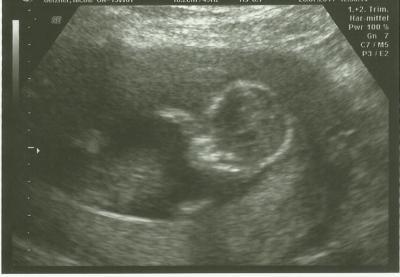Bild zu Unser Mäuschen :) - Forum für Februar - Mamis