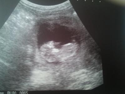 Bild zu Happy Happy Happy - Forum für Februar - Mamis