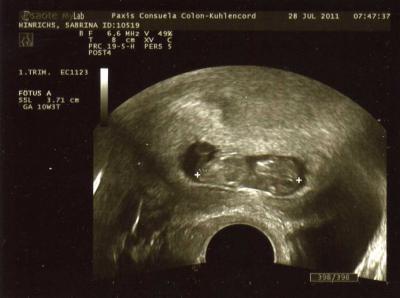 Bild zu Unser neustes Bild :) - Forum für Februar - Mamis