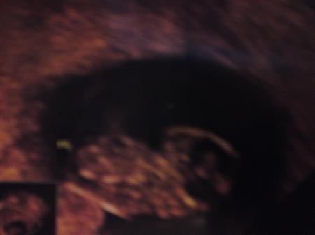 Bild zu 