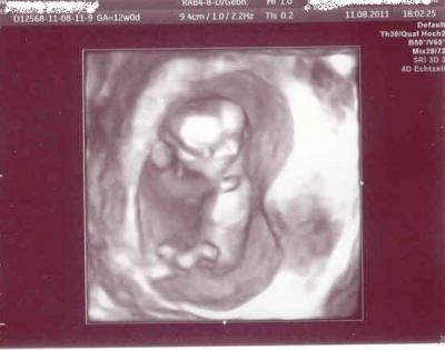Bild zu 3D Foto - Forum für Februar - Mamis