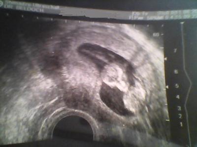 Bild zu Auch ein bildchen von meinem Krümelchen - Forum für Februar - Mamis