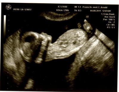 Bild zu Ein Bildchen vom Würmel - Forum für Februar - Mamis