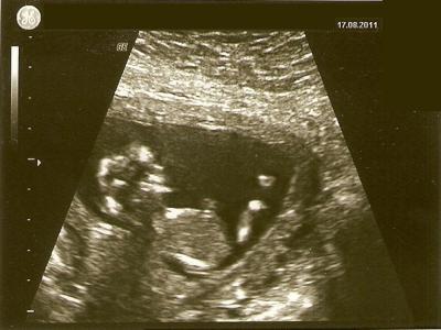 Bild zu Größe 13. SSW + bild - Forum für Februar - Mamis