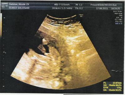 Bild zu Ein Bildchen von Söhnchen hihi - Forum für Februar - Mamis
