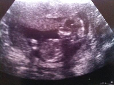 Bild zu Neues Foto von gestern :-) - Forum für Februar - Mamis