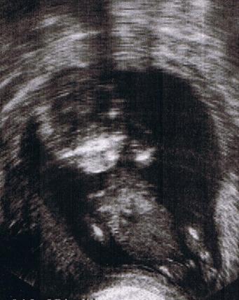 Bild zu Meld mich zurück - Forum für Februar - Mamis
