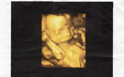 Bild zu foto - Forum für Februar - Mamis