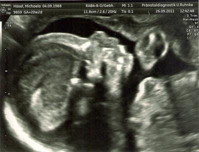 Bild zu Zurück von FD + OUTING!!!!!! - Forum für Februar - Mamis