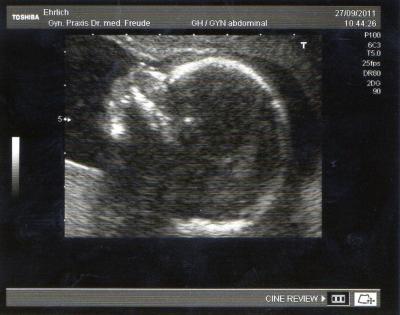 Bild zu VU mit Outing - Forum für Februar - Mamis