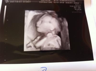 Bild zu FD und Outing :-) - Forum für Februar - Mamis