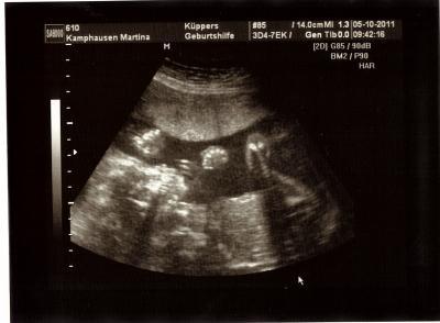 Bild zu Hatte heute Termin beim Gyn. - Forum für Februar - Mamis