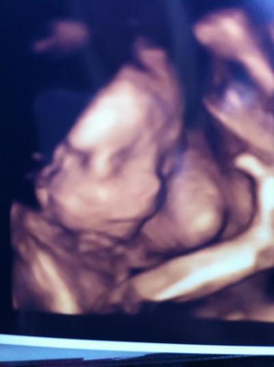 Bild zu Ebenfalls zurück von der FD! - Forum für Februar - Mamis