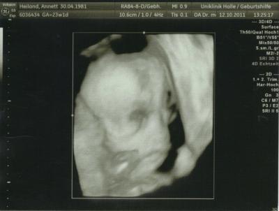 Bild zu zurück von FD, nochmal Outing bestätigung und fotos - Forum für Februar - Mamis