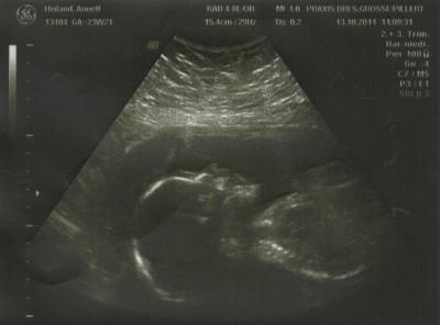 Bild zu hab gerade nen "schreck" bekommen beim FA - Forum für Februar - Mamis