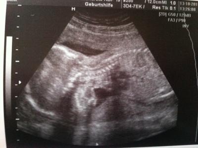 Bild zu neues babybild und bauchbild - Forum für Februar - Mamis