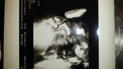 Bild zu WIR HABEN UNSER OUTING!!!! - Forum für Februar - Mamis