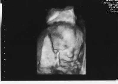 Bild zu Bericht FD + Outing - Forum für Februar - Mamis