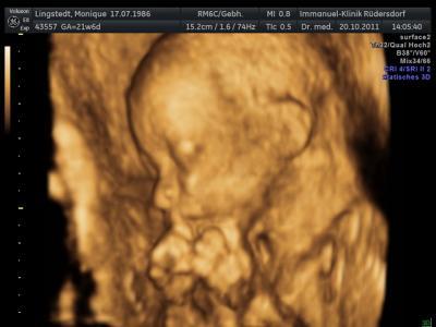 Bild zu FD - Forum für Februar - Mamis