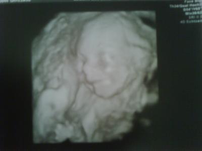 Bild zu Doppler Ultraschall + 3D bild - Forum für Februar - Mamis