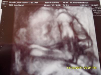 Bild zu Kann das sein? - Forum für Februar - Mamis